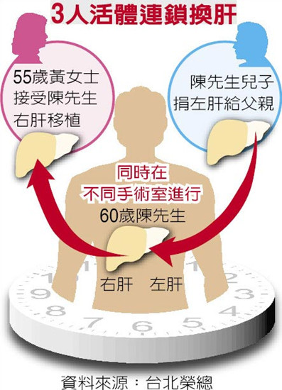 全臺首例臺北榮總醫(yī)院完成“3人活體連鎖換肝”